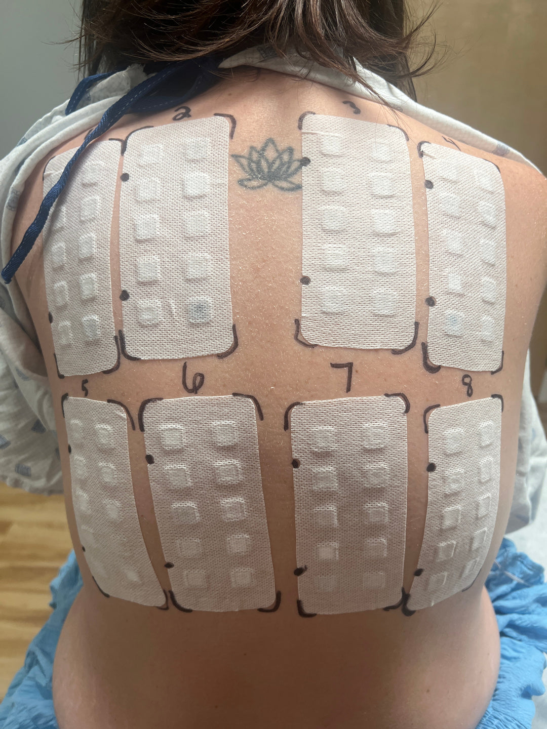 Why Allergy Testing Might Be the Missing Step in Your Skincare Journey