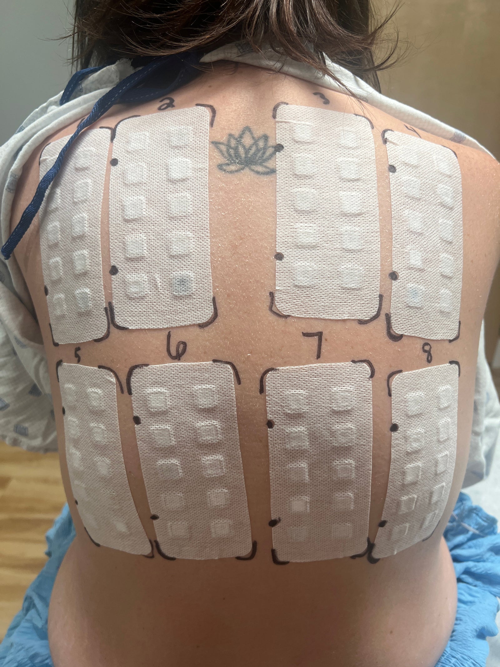 Why Allergy Testing Might Be the Missing Step in Your Skincare Journey - The Flake Escape